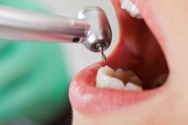 Best Emergency Treatment for Oral Infections in Muniz, TX